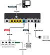 zyxel-vmg8924-b10d-schema-ftth-voce.gif